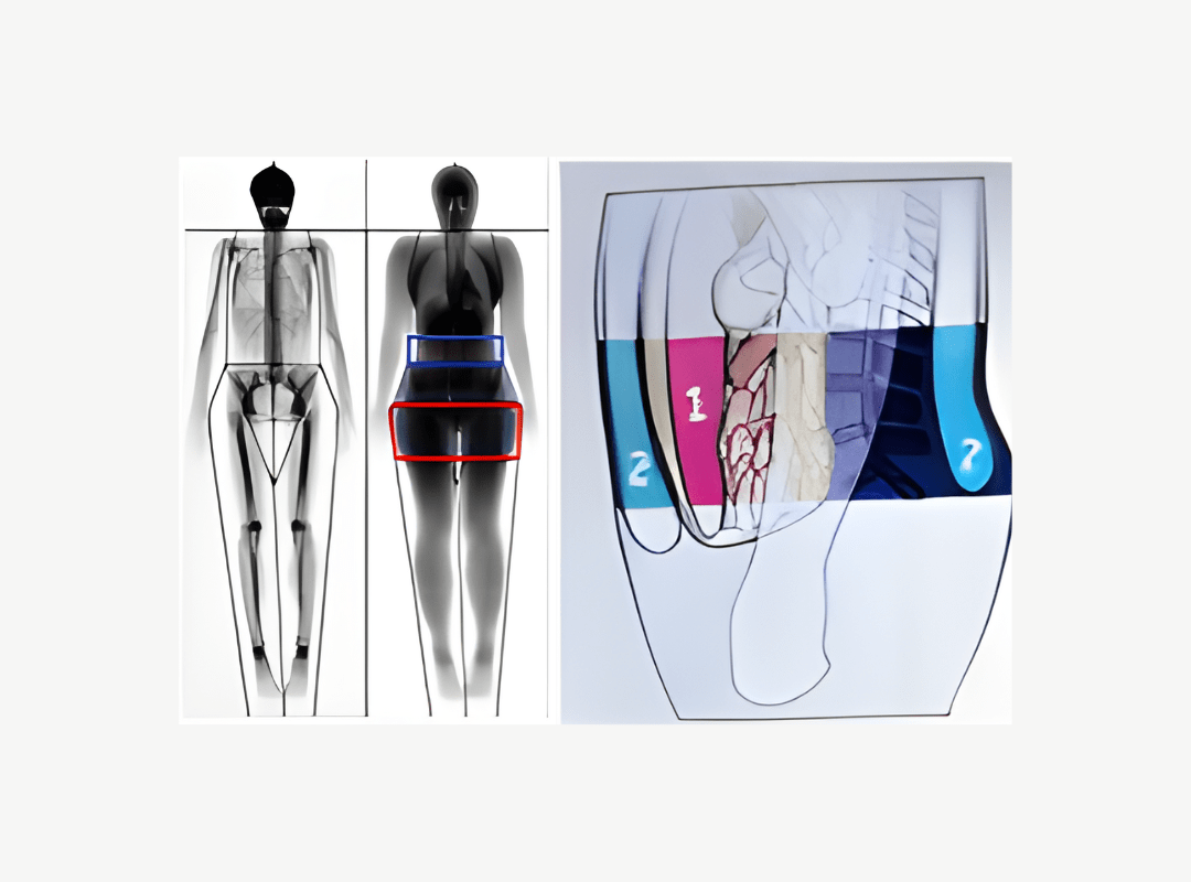 Dexa Scan (3)